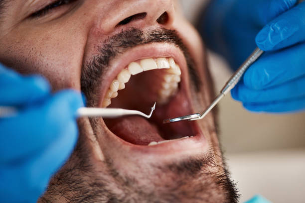 Best Emergency Broken Tooth Repair in Vonore, TN